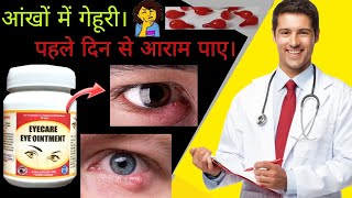 Ayurvedic medicine for Styes | आंखों में फुंसी करे ठीक | Dry Eye Problem #pichki