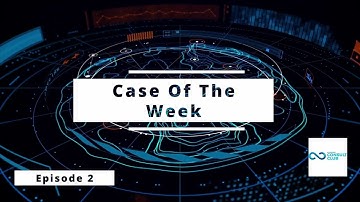Case of the week - Market Entry Case