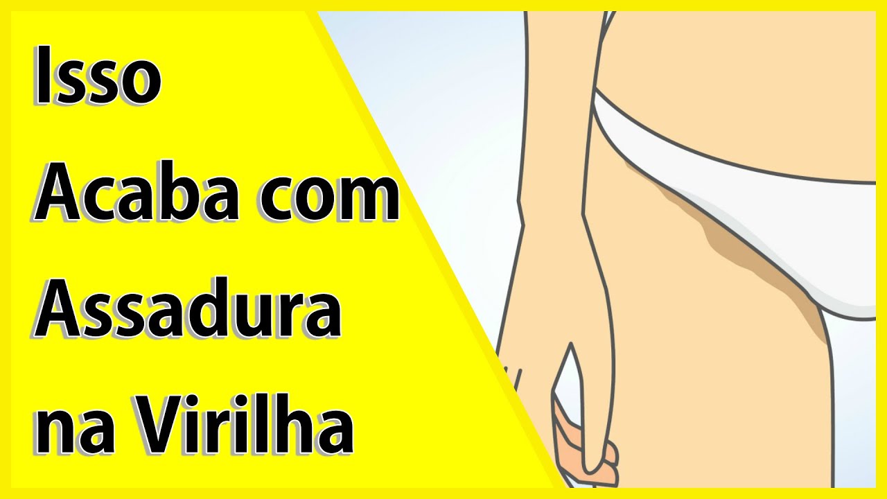 Como Tratar Assadura na Virilha em Casa - YouTube