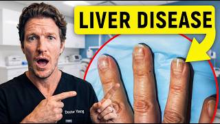 12 Signs Your LIVER Is Silently Failing (Catch It Before It's Too Late)