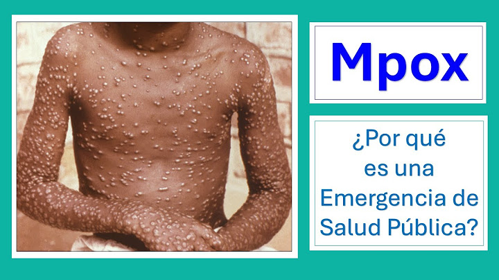 ¿Por qué Mpox es una Emergencia de Salud Pública?
