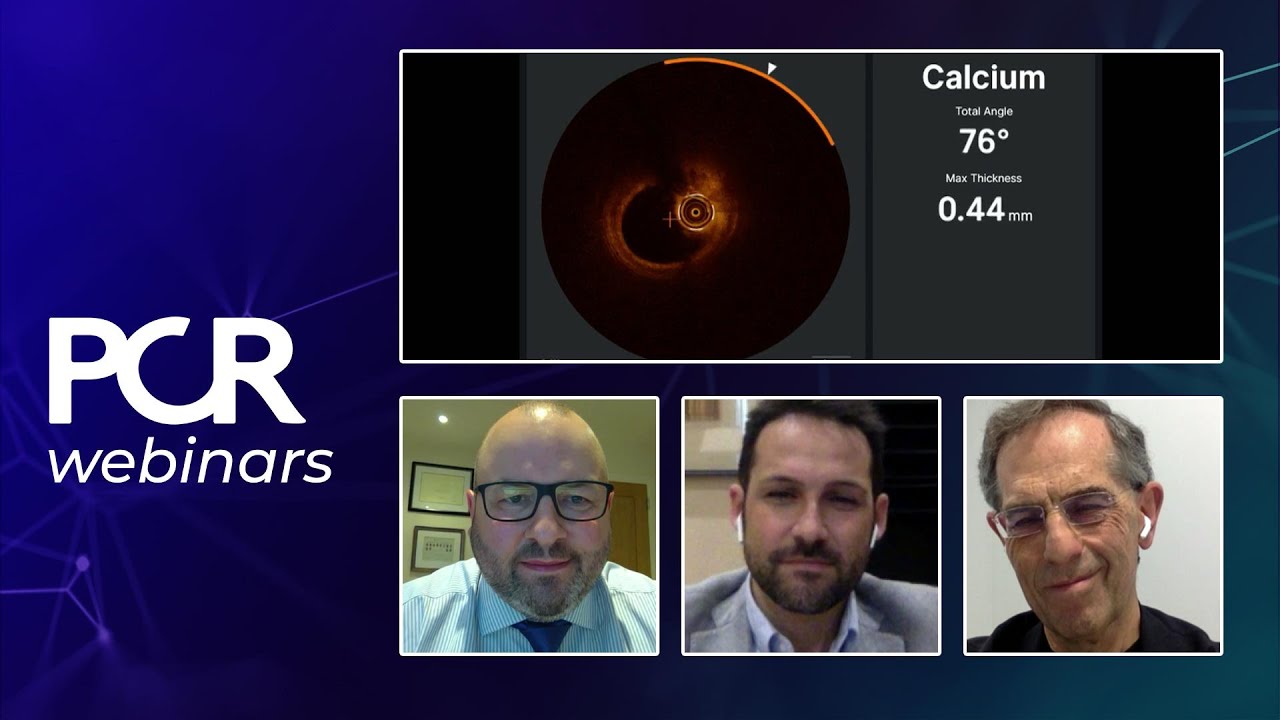 How OCT/XRay imaging workflow can improve procedure in treating calcified lesions - Webinar