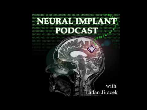 Neural Implant roundtable discussion on the discussion of neurotechnology in the public
