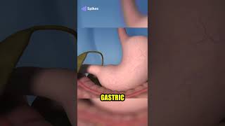 Roux-en-Y Gastric Bypass