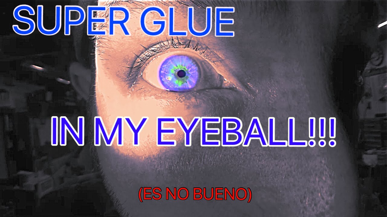 Super Glue In My Eye What I Did To Get It Out