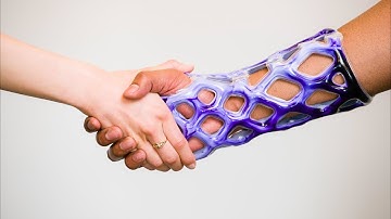 Innovative New Arm Cast is Waterproof, Lightweight and Breathable