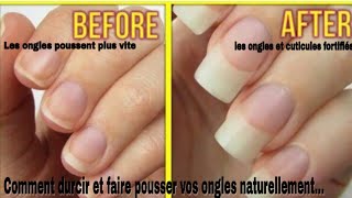 Comment Faire Pousser Et Durcir Les Ongles, Les Fortifiés À Lhuile En 7 Jours Didi Zochard