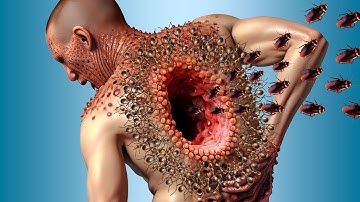 Deep Cleaning Animation - ASMR Removing Ticks, Maggots and insects from Back