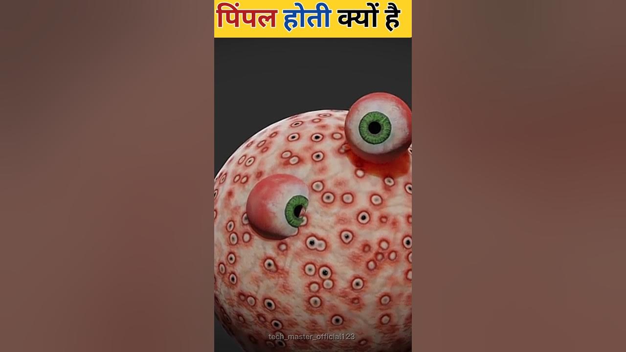 Why Do Pimples Occur tech master official123 fact shorts YouTube why-do-pimples-occur-tech-master-official123-fact-shorts-youtube