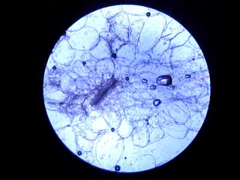a yogurt microscope under tomato YouTube microscope under a yogurt microscope under tomato YouTube microscope under