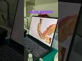 Digital Dentistry | Digital Dental Scan at Raj Nagar Clinic Ghaziabad | Dental Crown