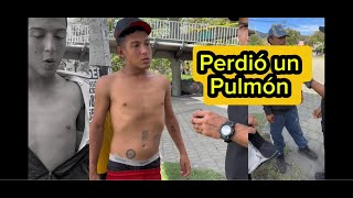 Perdió Un Pulmón Por El Barrismo