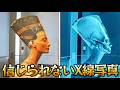 【衝撃映像】科学者も戦慄...！信じられないX線写真15選。36年妊娠した男性？体内で成長する木！？#X線の謎 #医学的驚異 #ミステリー #人体の謎 #考古学 #未解明現象 #医学史