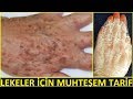 EL LEKELERİ NASIL TEMİZLENİR? LEKE GİDERİCİ MUHTEŞEM TARİF  (% 100 ETKİLİ) EL BAKIMI