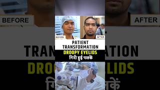 Droopy Eyelid Fixed in 10 Minutes!