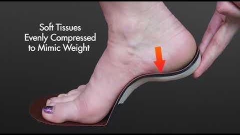 Sole Supports MASS Posture Orthotics: Calibrated Leaf Springs and the Gait Cycle