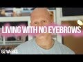 What It's Like Living With No Eyebrows // 52 Weeks
