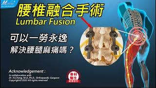 【自診自醫】腰椎融合手術可以一勞永逸解決腰腿麻痛嗎？(B18)(3D Animation)