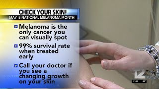 OHA says to check your skin for melanoma