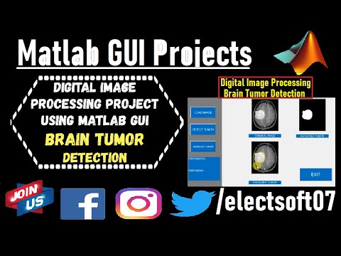 Brain Tumor Detection Project With Source Code | brain tumor detection using matlab code #MATLAB