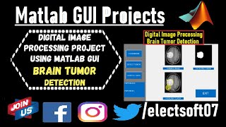 Brain Tumor Detection Project With Source Code | brain tumor detection using matlab code #MATLAB