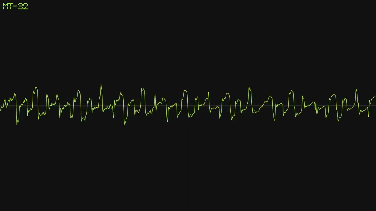 Chalkeaters - It Just Works [Roland MT-32 Cover]