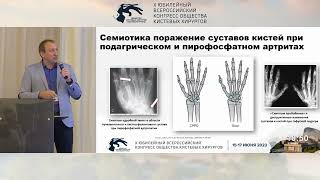 Кабаков А.В.: дифференциальная диагностика артрита мелких суставов кистей.