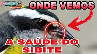 Download Lagu sibite 🔥com saúde como saber 🔥 borrachinha branca sem saúde ? 🔥borrachinha vermelha com saúde ?🔥 MP3 Download Lagu sibite 🔥com saúde como saber 🔥 borrachinha branca sem saúde ? 🔥borrachinha vermelha com saúde ?🔥 MP3