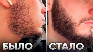 УВЕЛИЧИЛ ГУСТОТУ бороды за 4 месяца | Средство для роста бороды Mr. Volos