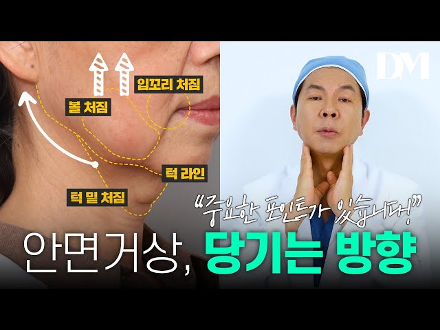 안면거상, 당기는 방향에 따라 효과가 다르다?🤔 #안면거상 #동안성형 #리프팅