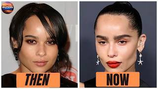 8 Hollywood Stars Who Regretted Buccal Fat Removal – Shocking Transformations | Then and Now 2026