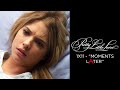 Pretty Little Liars - Hanna Wakes Up In The Hospital - 