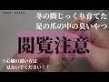 【足爪おそうじ♪】スッキリする足爪のゴミ取り作業動画　#足の爪　#足の爪のゴミ　#nails 【苦手な方はご視聴をお控えください】