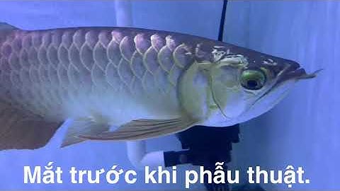 Phẫu thuật mắt cá rồng