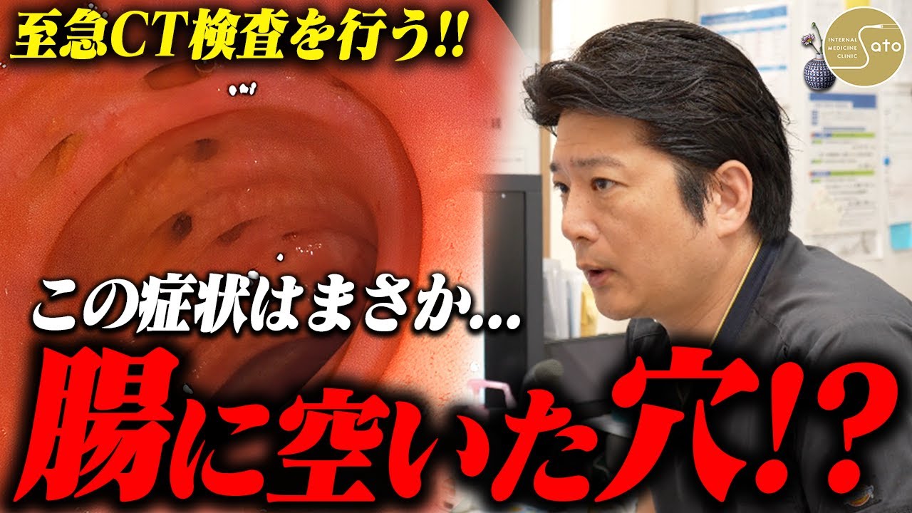 『これは憩室炎だ！』腹部の激痛を訴える患者... 医師が症状から病を見抜き、緊急CT検査を敢行！