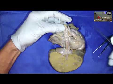 Anatomy Session #5: Heteotaxy