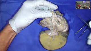 Anatomy Session #5: Heteotaxy