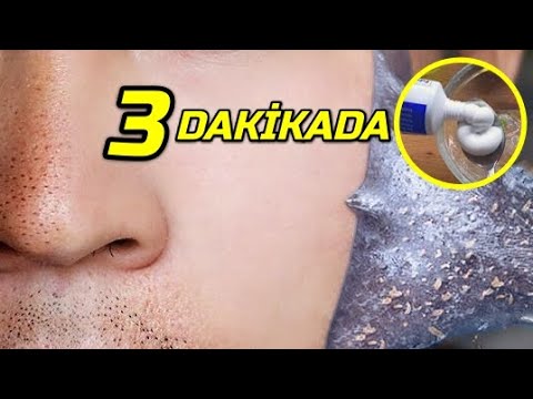 İlk Yaptığınızda Şaşıracaksınız ! DİŞ MACUNU İLE 3 DAKİKADA Siyah Nokta Yok Etme │ Güzellik Bakım