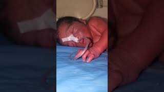 Black baby in inventory incubation process his face full with pagir newborn baby