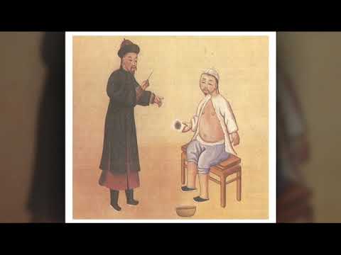 Curiosidades de la acupuntura