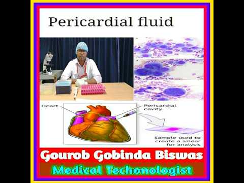 Pericardial Fluid Analysis.What Is Pericardium,Pericardial Effusion, Sign,symptoms, causes, report.
