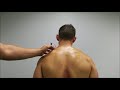 Neck Cupping Variations