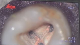 Leica Microscope Technology for Dentistry