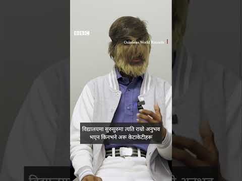 Facial hair: भारतका १८ वर्षे किशोर 'अनुहारमा सर्वाधिक रौँ भएका व्यक्ति' - BBC Nepali Sewa