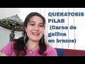 CARNE DE GALLINA EN BRAZOS  "Queratosis Pilar" TRATAMIENTO