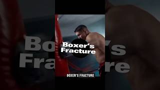 Boxer’s Fractures: What you need to know 👊🦴 #shorts