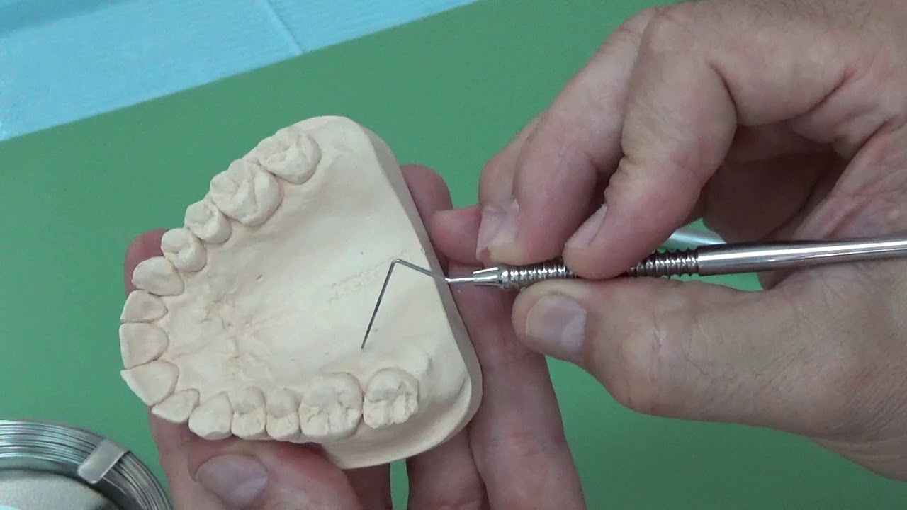 Elaboración Adams ortodoncia removible