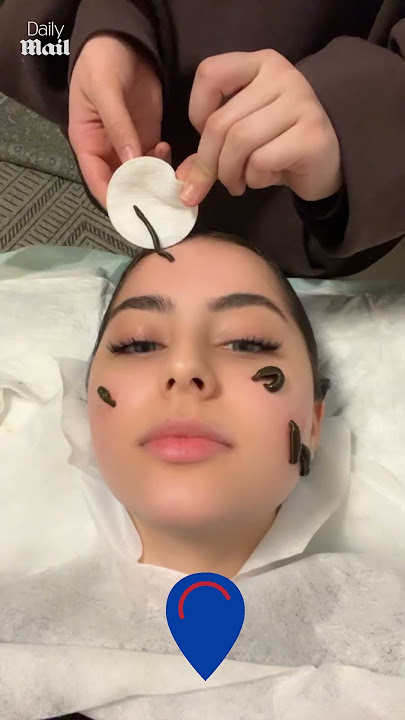 Woman gets leech facial