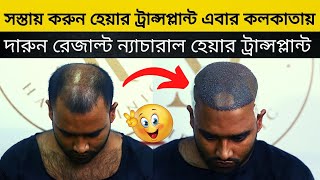 EXCELLENT HAIR TRANSPLANT IN KOLKATA || অসাধারণ HAIR TRANSPLANT এবার KOLKATA এ  #shorts