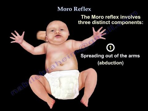 Moro Reflex - Everything You Need To Know - Dr. Nabil Ebraheim